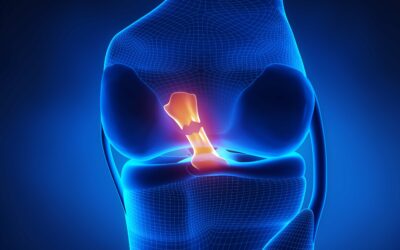 ACL Injury