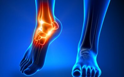 Foot & Ankle Fractures
