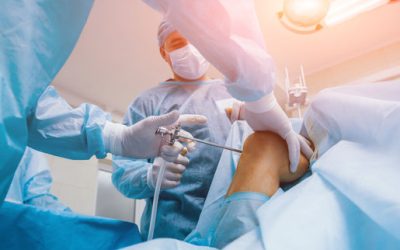 Knee Surgery