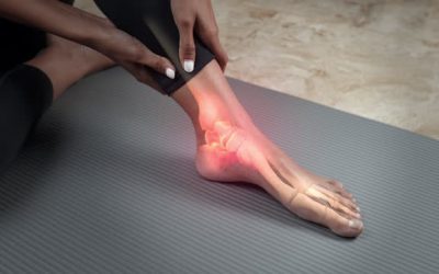 Sprains and Strains