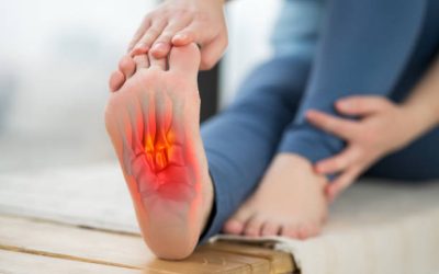 Plantar Fasciitis