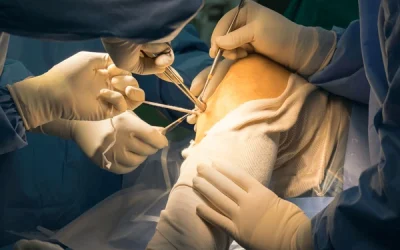 Anterior Cruciate Ligament (ACL) Surgery