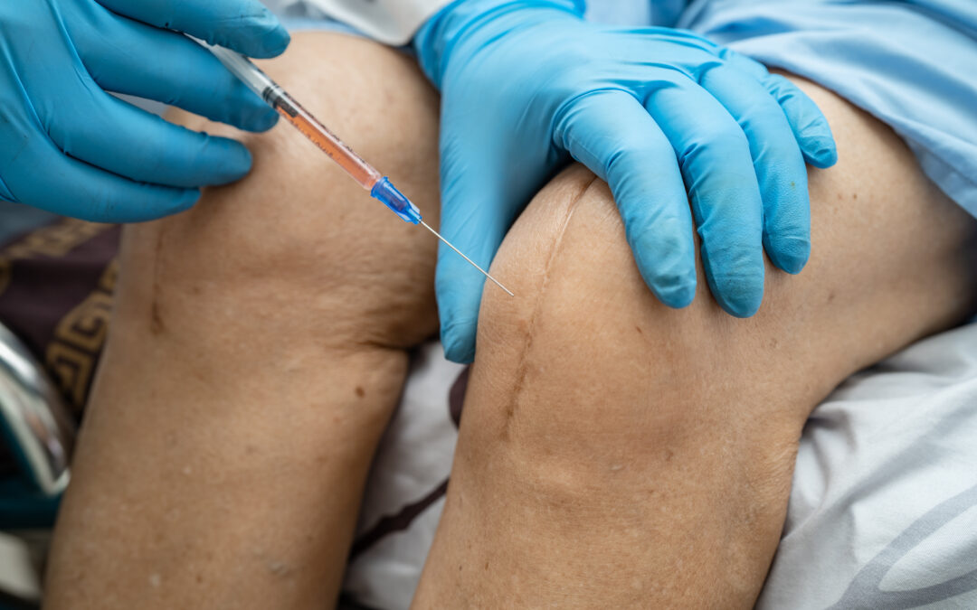 What Happens During an Arthrosamid Injection? A Step-by-Step Guide