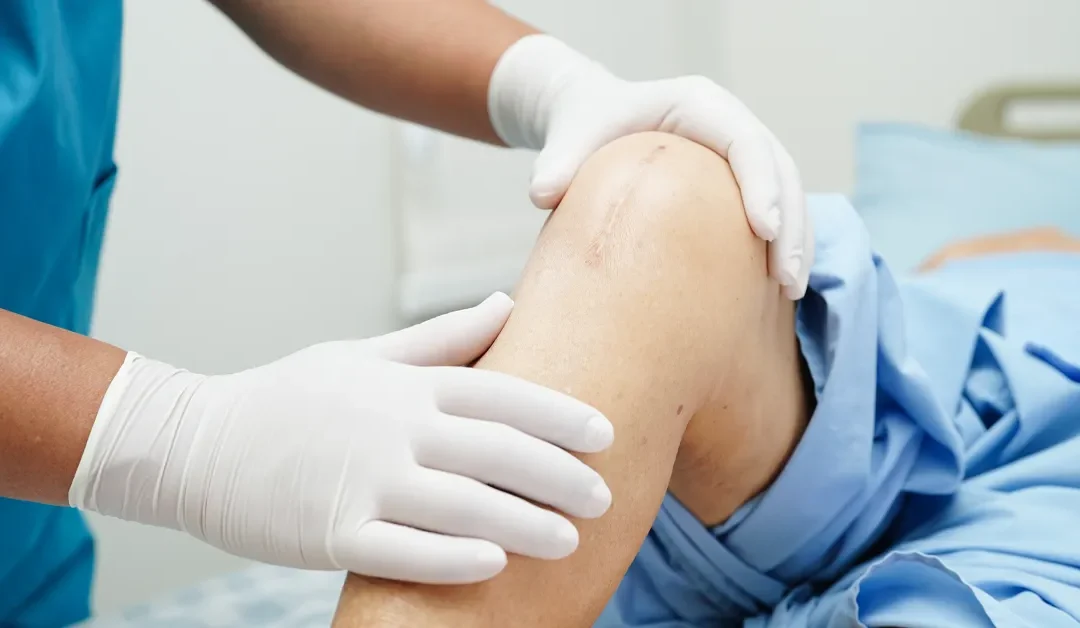 How Much Does Private Knee Replacement Cost in the UK in 2026?
