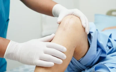 How Much Does Private Knee Replacement Cost in the UK in 2026?