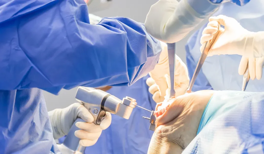 What Are the Risks of Knee Replacement Surgery? A Consultant’s Honest Guide