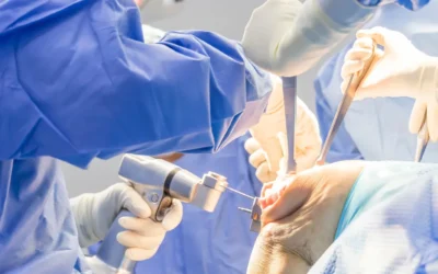 What Are the Risks of Knee Replacement Surgery? A Consultant’s Honest Guide